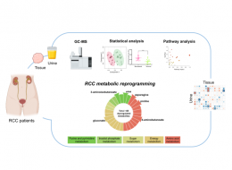 Metabolic signature of renal cell carcinoma tumours and its correlation with the urinary metabolome